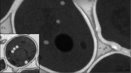 Zellbiologie: Wie Fette die Zellmembran stressen