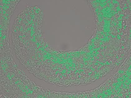 Life Sciences Innovations: Kokain-Biosynthese: Die Rolle der Methylecgonon-Reduktase Life Sciences Innovations: Kokain-Biosynthese: Die Rolle der Methylecgonon-Reduktase