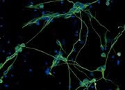 Life Sciences Innovations: Hautzellen umprogrammieren