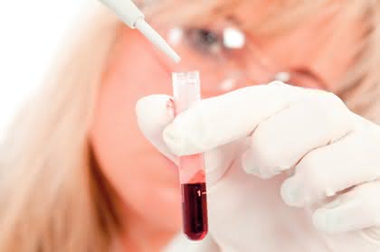Micro-Array-Handling: Proteine und Enzyme  in Therapie und Diagnostik