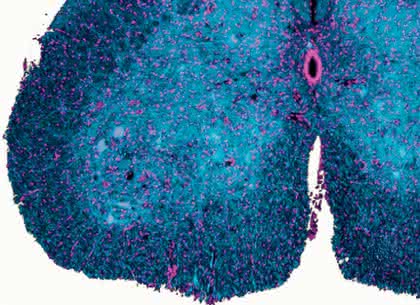 Life Sciences Innovations: Neues aus der Biotech-Branche