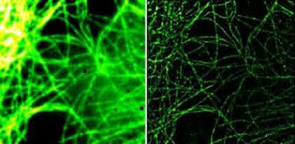 News: Lizenzvertrag zu Fluoreszenzfarbstoffen