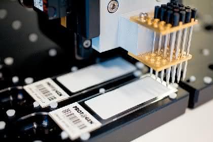 Protein-Microarrays UNIchip: Spezifitätsanalyse von Antikörpern