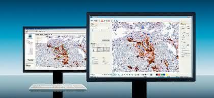 Mikroskopsoftware: Verbindet digitale und molekulare Pathologie