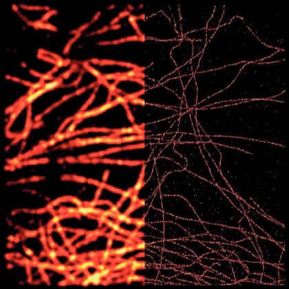 Labortechnik: Im Zeichen von  Superresolution