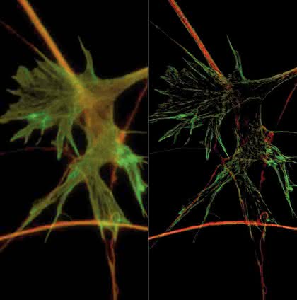 Labortechnik: Im Zeichen von  Superresolution