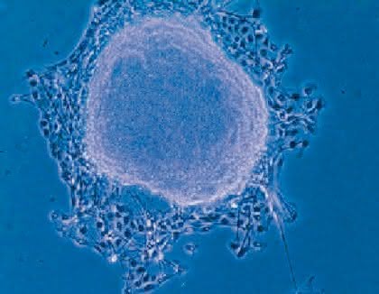 Life Sciences Innovations: Regenerative Medizin: