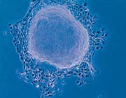 Life Sciences Innovations: Regenerative Medizin:
