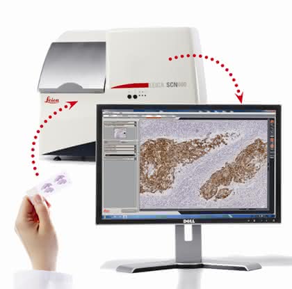 News: Bildanalyse-Software für die digitale Pathologie
