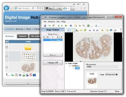 News: Bildanalyse-Software für die digitale Pathologie