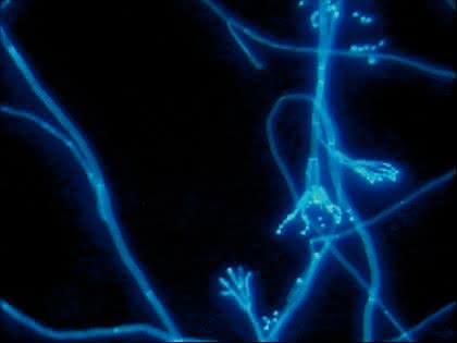 Routinemikroskop Medicus mit Fluoreszenz-Einsatz: Direktnachweis von Mykosen