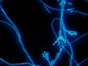 Routinemikroskop Medicus mit Fluoreszenz-Einsatz: Direktnachweis von Mykosen
