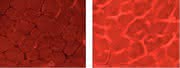 Life Sciences Innovations: Gendoping –