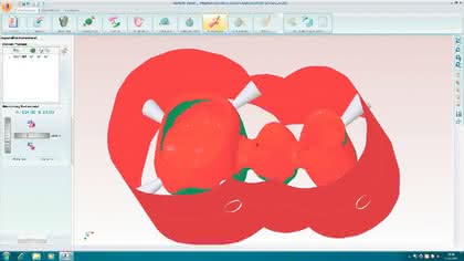 Software: Automatisiert zum Zahnersatz Software: Automatisiert zum Zahnersatz