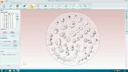 Software: Automatisiert zum Zahnersatz Software: Automatisiert zum Zahnersatz