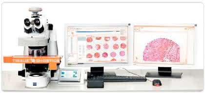 TMA-Analysesystem TissueFAXSplus: Effiziente und quantitative TMA-Analyse