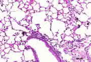 News: Wie gefährlich sind Kohlenstoff-Nanopartikel?