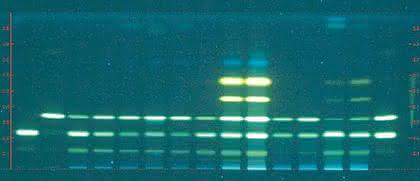 Bioluminex-Assay: HPTLC plus Biolumineszenz Bioluminex-Assay: HPTLC plus Biolumineszenz
