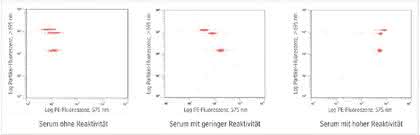 Fachbeitrag: Multiplex-Partikel-Tests Fachbeitrag: Multiplex-Partikel-Tests