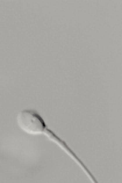 Fachbeitrag: Neue Techniken in der Reproduktionsmedizin Fachbeitrag: Neue Techniken in der Reproduktionsmedizin