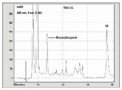 Fachbeitrag: Drogenanalytik  in der Notfallmedizin