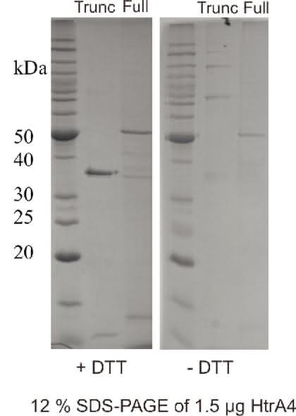 Rekombinante humane Serinprotease HtrA4: Rekombinante humane Serinprotease HtrA4 Rekombinante humane Serinprotease HtrA4: Rekombinante humane Serinprotease HtrA4