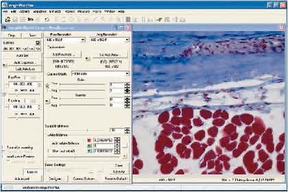 Mikroskopkamera ProgRes: Neuer Image-Pro Treiber für ProgRes® 