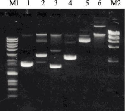 Plasmid-Mini-Kit Hi Yield: Hohe Ausbeute und reinste DNA Plasmid-Mini-Kit Hi Yield: Hohe Ausbeute und reinste DNA