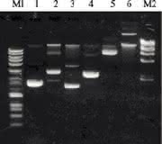 Plasmid-Mini-Kit Hi Yield: Hohe Ausbeute und reinste DNA