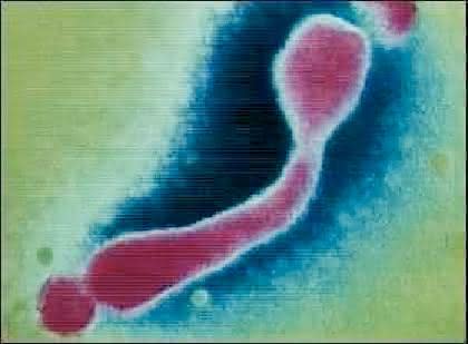 Fachbeitrag: „Mycoplasma  laboratorium“