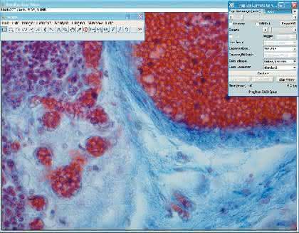 Bildanalysesoftware ImageJ: Neuer Treiber für Mikroskopkameras 