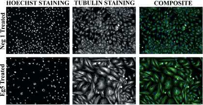 Liquid-Robotics: Effektives  Hochdurchsatz-RNAi-Screening