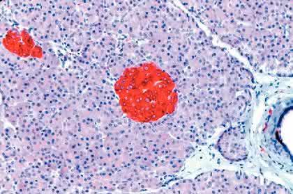 Test-Kit ExpressArt FFPE RNA-ready: Hochwertige RNA aus Gewebeproben