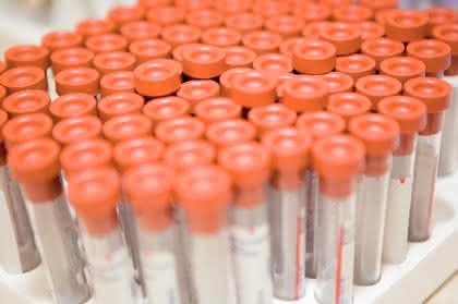 Labortechnik: RFID im Labor