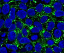 In den induzierten pluripotenten Stammzellen einer Patientin befindet sich das Glut1-Protein vor allem im Zellinneren (grün markiert).