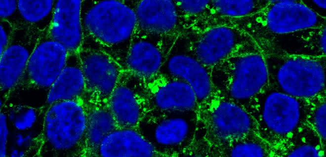In den induzierten pluripotenten Stammzellen einer Patientin befindet sich das Glut1-Protein vor allem im Zellinneren (grün markiert). In den induzierten pluripotenten Stammzellen einer Patientin befindet sich das Glut1-Protein vor allem im Zellinneren (grün markiert).