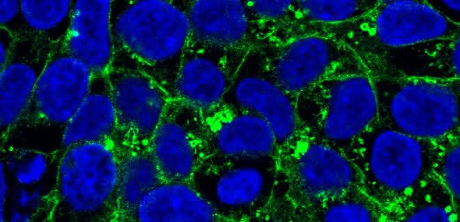 In den induzierten pluripotenten Stammzellen einer Patientin befindet sich das Glut1-Protein vor allem im Zellinneren (grün markiert).