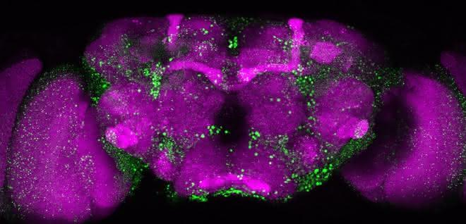 Mikroskopische Aufnahme eines Fliegengehirns. In Grün sind die Huntingtin-Ablagerungen erkennbar, die durch das mutierte Huntingtin-Protein entstehen.