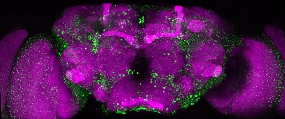 Mikroskopische Aufnahme eines Fliegengehirns. In Grün sind die Huntingtin-Ablagerungen erkennbar, die durch das mutierte Huntingtin-Protein entstehen. Mikroskopische Aufnahme eines Fliegengehirns. In Grün sind die Huntingtin-Ablagerungen erkennbar, die durch das mutierte Huntingtin-Protein entstehen.