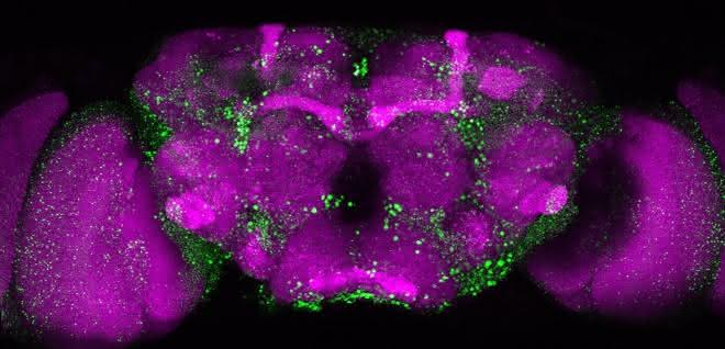 Mikroskopische Aufnahme eines Fliegengehirns. In Grün sind die Huntingtin-Ablagerungen erkennbar, die durch das mutierte Huntingtin-Protein entstehen. Mikroskopische Aufnahme eines Fliegengehirns. In Grün sind die Huntingtin-Ablagerungen erkennbar, die durch das mutierte Huntingtin-Protein entstehen.