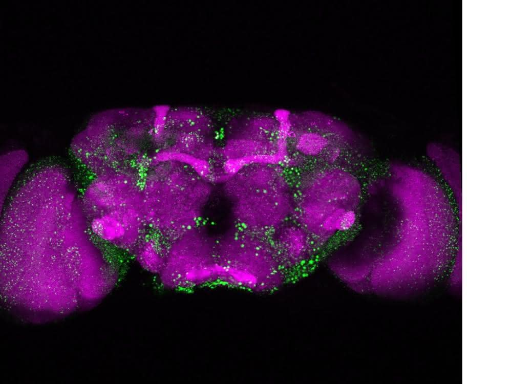 Mikroskopische Aufnahme eines Fliegengehirns. In Grün sind die Huntingtin-Ablagerungen erkennbar, die durch das mutierte Huntingtin-Protein entstehen. Mikroskopische Aufnahme eines Fliegengehirns. In Grün sind die Huntingtin-Ablagerungen erkennbar, die durch das mutierte Huntingtin-Protein entstehen.