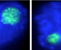 Der Nukleolus (in grün) von Makrophagenzellen schrumpft bei einer bakteriellen Infektion (links: nicht infizierter Makrophage, rechts: bakteriell infizierter Makrophage).