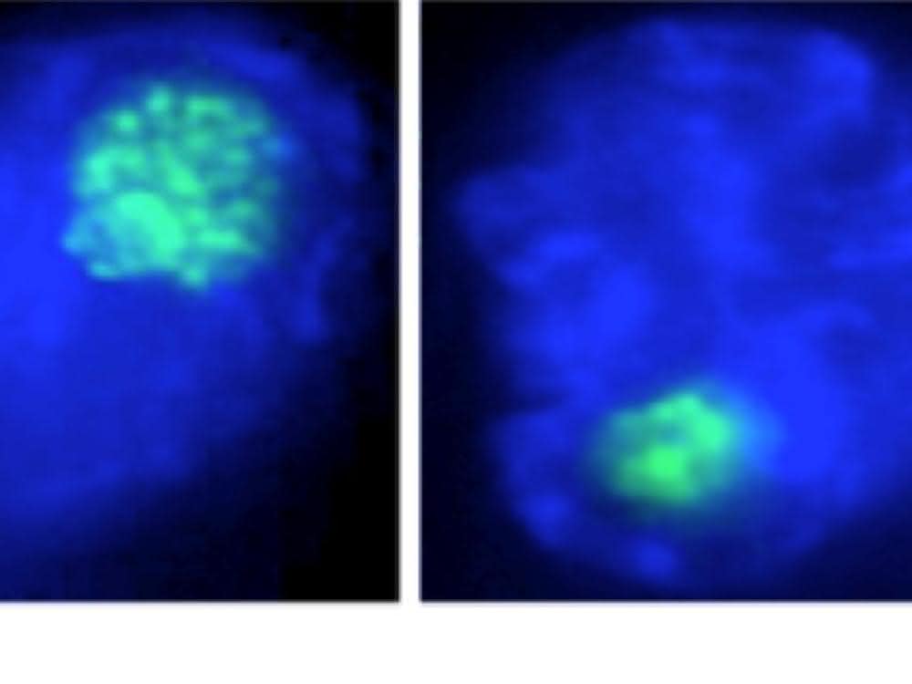 Der Nukleolus (in grün) von Makrophagenzellen schrumpft bei einer bakteriellen Infektion (links: nicht infizierter Makrophage, rechts: bakteriell infizierter Makrophage).