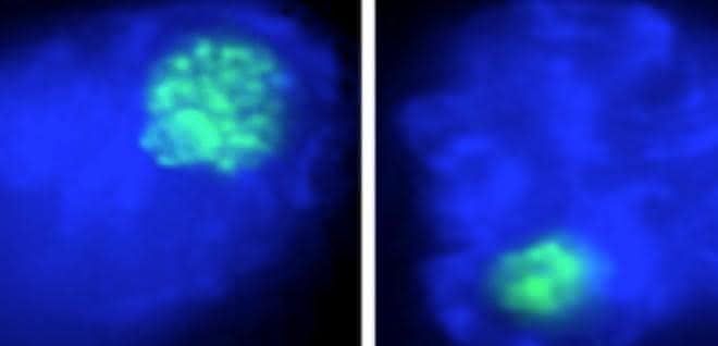 Der Nukleolus (in grün) von Makrophagenzellen schrumpft bei einer bakteriellen Infektion (links: nicht infizierter Makrophage, rechts: bakteriell infizierter Makrophage).