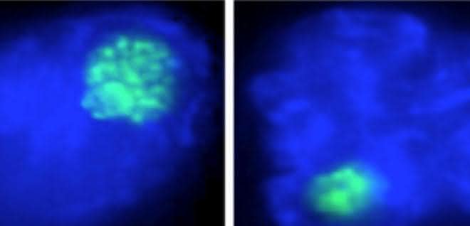 Der Nukleolus (in grün) von Makrophagenzellen schrumpft bei einer bakteriellen Infektion (links: nicht infizierter Makrophage, rechts: bakteriell infizierter Makrophage).