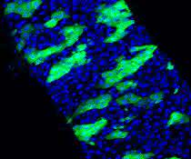 Abschnitt aus dem Darm einer Fruchtfliege: Die Stammzellen sind mit GFP grün markiert.