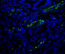 Fluoreszenzaufnahme aus der Nierenbiopsie einer DRESS-Patientin mit HHV-6-kodierter sncRNA-U14 (grün).