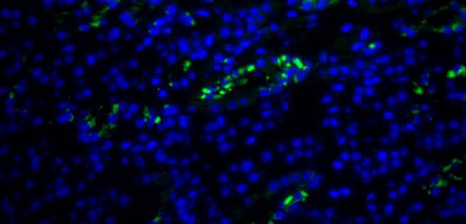 Fluoreszenzaufnahme aus der Nierenbiopsie einer DRESS-Patientin mit HHV-6-kodierter sncRNA-U14 (grün). Fluoreszenzaufnahme aus der Nierenbiopsie einer DRESS-Patientin mit HHV-6-kodierter sncRNA-U14 (grün).
