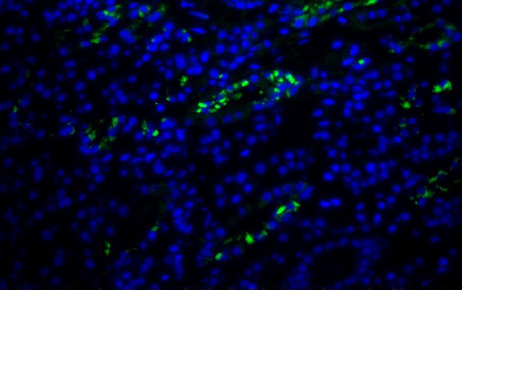Fluoreszenzaufnahme aus der Nierenbiopsie einer DRESS-Patientin mit HHV-6-kodierter sncRNA-U14 (grün). Fluoreszenzaufnahme aus der Nierenbiopsie einer DRESS-Patientin mit HHV-6-kodierter sncRNA-U14 (grün).