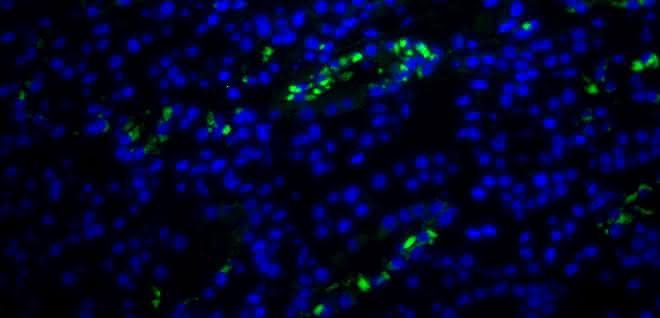 Fluoreszenzaufnahme aus der Nierenbiopsie einer DRESS-Patientin mit HHV-6-kodierter sncRNA-U14 (grün). Fluoreszenzaufnahme aus der Nierenbiopsie einer DRESS-Patientin mit HHV-6-kodierter sncRNA-U14 (grün).